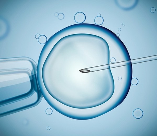 דיקור סיני IVF (שילוב שפשוט עובד!)